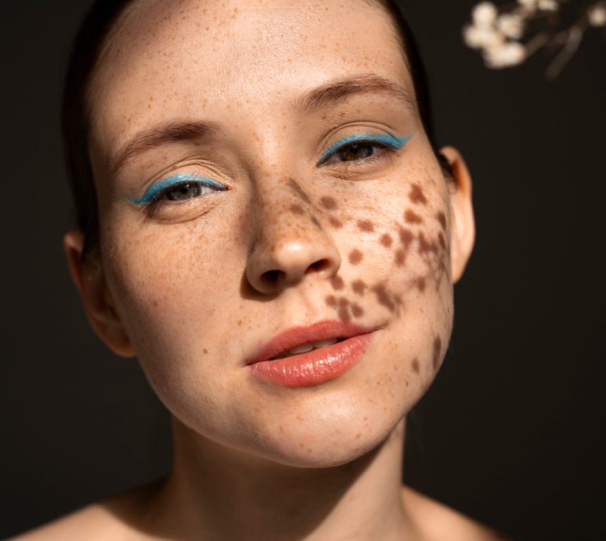 Пігментація-шкіри--ефективні-методи-лікування-фото-1